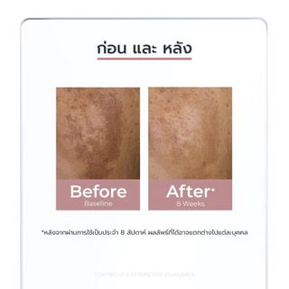 EUCERIN EVEN SKIN BRIGHTENING SERUM 30ML. เซรั่มจัดการฝ้าแดด จุดด่างดำแก้ยาก