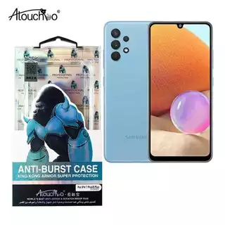 เคสใสแข็ง สำหรับ Samsung A54 A24 A34 A14 A23 A13 A04 A04S A03 A03S A73 A53 A33 เคสคิงคอง เคสใสกันกระแทก