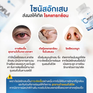 (พร้อมส่ง) C-BIOFLA ลดอาการภูมิแพ้ บรรเทาอาการหวัด ลดน้ำมูก หอบหืด แก้อ่อนเพลีย บำรุงปอด ปอดอักเสบ