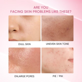 SKINTIFIC Niacinamide Bright Boost Clay Mask Stick ช่วยปรับสีผิวให้สม่ำเสมอและไบรท์ยิ่งขึ้น มาร์คโคลน มาร์คหน้า
