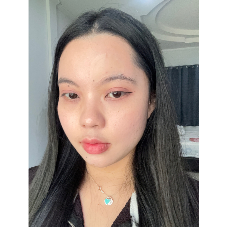 dermaAngel Salicyilc Acne Moon patch for Day 4 ชิ้น 4 กล่อง (ขนาดใหญ่พิเศษ) - รูปที่ 4