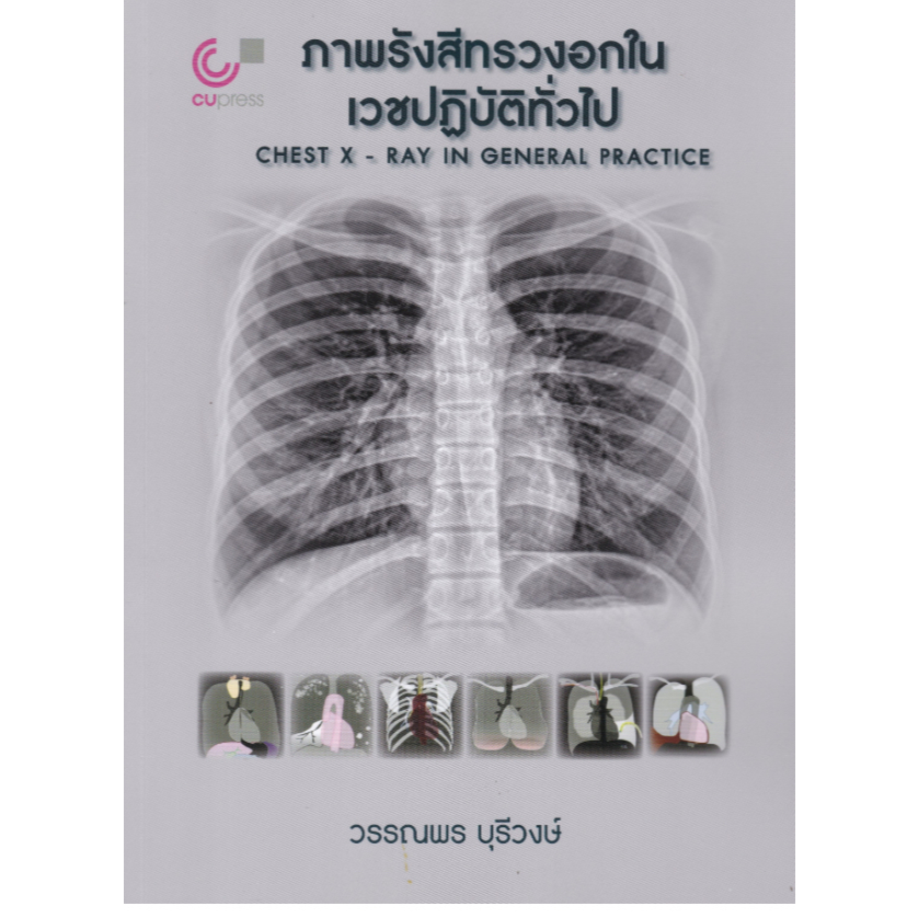 [พร้อมส่ง]  ภาพรังสีทรวงอกในเวชปฏิบัติทั่วไป (CHEST X-RAY IN GENERAL PRACTICE) (9789740343653) c112 cuup