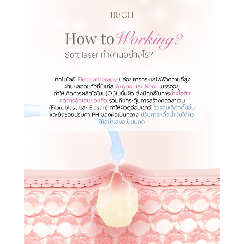 IRICH Soft Laser High Frequency+ เกรดทางการแพทย์  ฆ่าเชื้อสิว