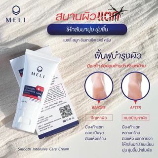 ครีมคุณหมอ no สเตอรอย สะเก็ดเงิน แผลเป็น ผิวแห้ง ผิวแตก ขนคุด ผื่นแพ้ ส้นเท้าแตก 30 g.