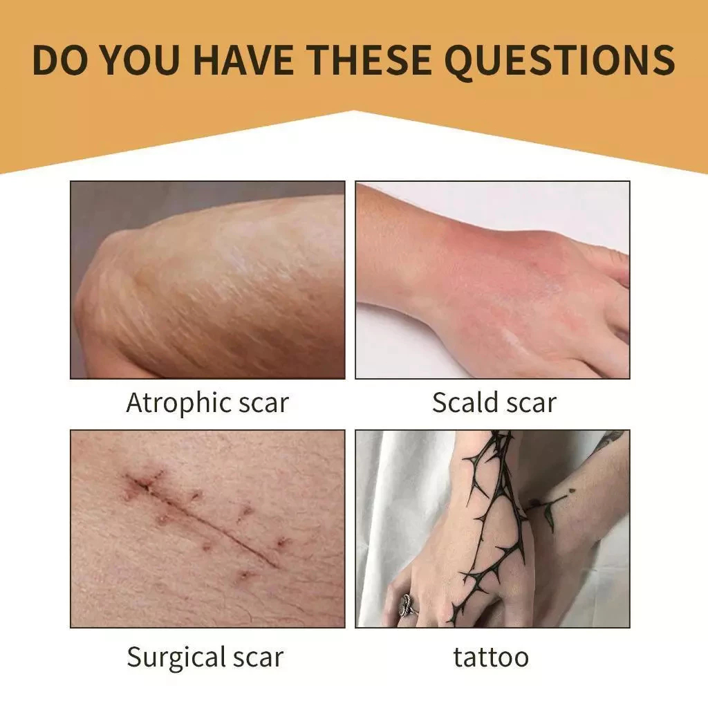 Jaysuing เทปปิดรอยสัก เทปปกปิดรอยแผลเป็น ปกปิดรอยสั ปกปิดรอยแผเป็นจากสิว กันน้ํา ติดทนนาน รอยแผลเป็นจากสิว กันน้ำ - รูปที่ 4