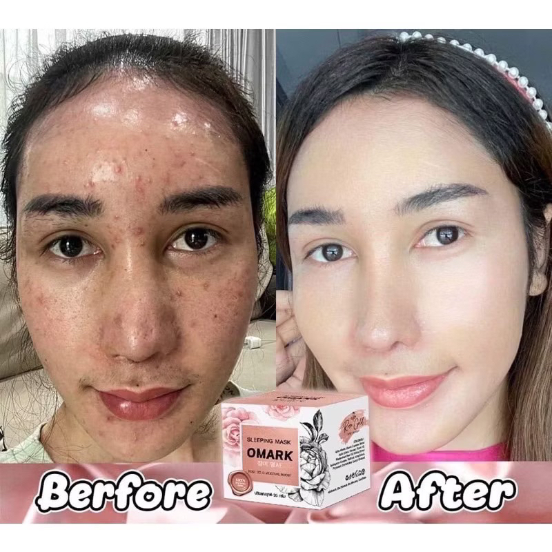 Omarkของบาสตี้ มาร์คบาสตี้