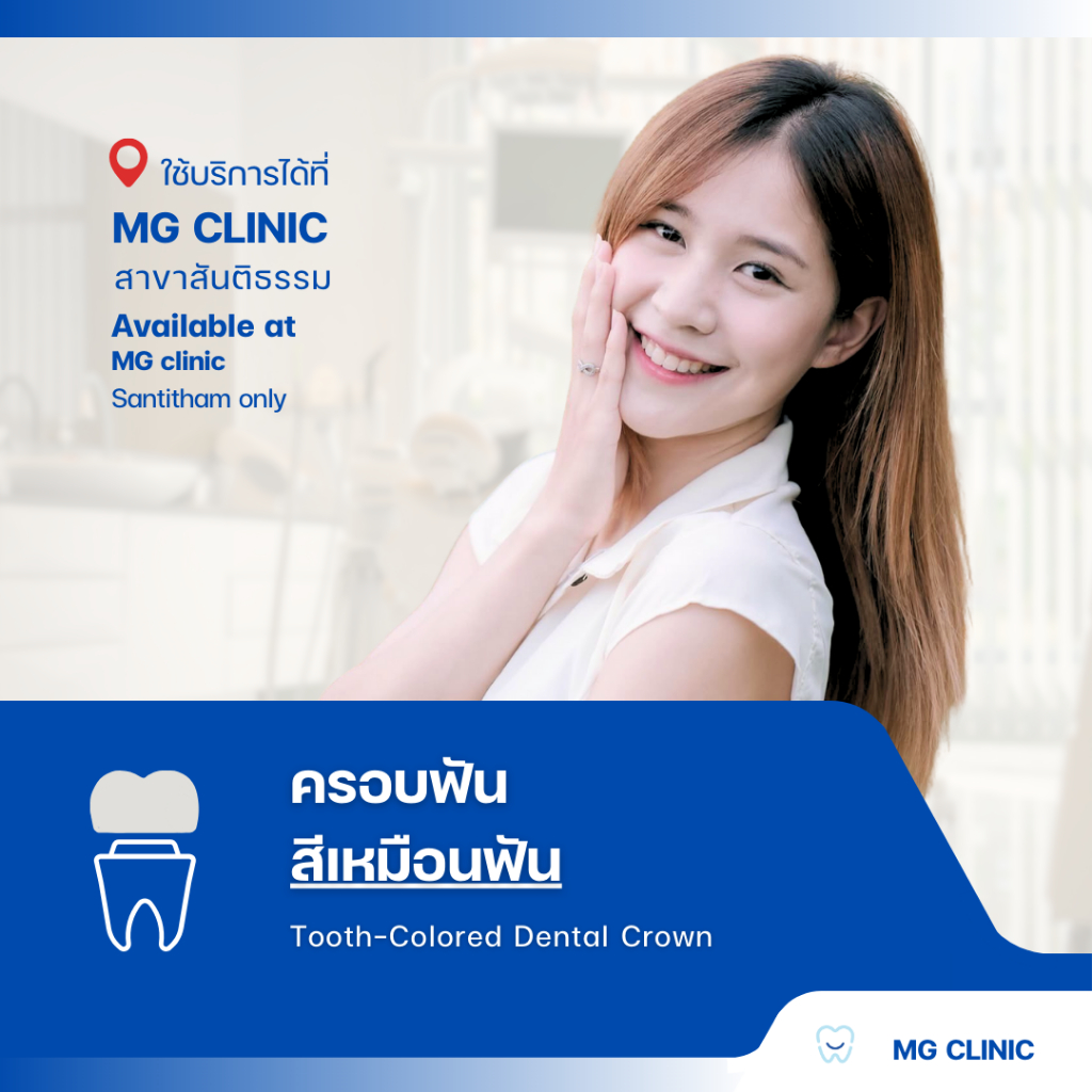 โปรแกรมครอบฟันสีเหมือนฟัน (Tooth-Colored Dental Crown) - MG Dental Clinic