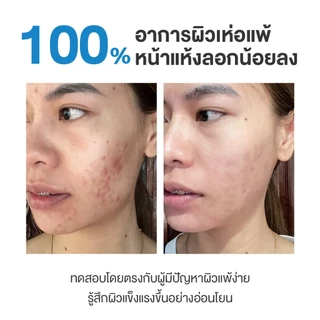 Dermie B5 Soothing Solution moisturizer 40g. มอยเจอรไรเซอร์ ไลท์บาล์ม เติมความชุ่มชื้น ผิวแพ้ง่ายใช้ได้