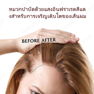 ✨HOT DEAL✨หมวกเลเซอร์อินฟราเรด สีแดง และสีฟ้า สําหรับปลูกผม 🚚จัดส่งจากไทย🚚TZR