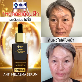 YANHEE ANTI MELASMA SERUM [ 1 ขวด ] ยันฮี แอนตี้ เมลาสม่า เซรั่มลด ฝ้า กระ ลดจุดด่างดำ แก้ฝ้า ผิวกระจ่างใส ผลัดเซลล์ผิว