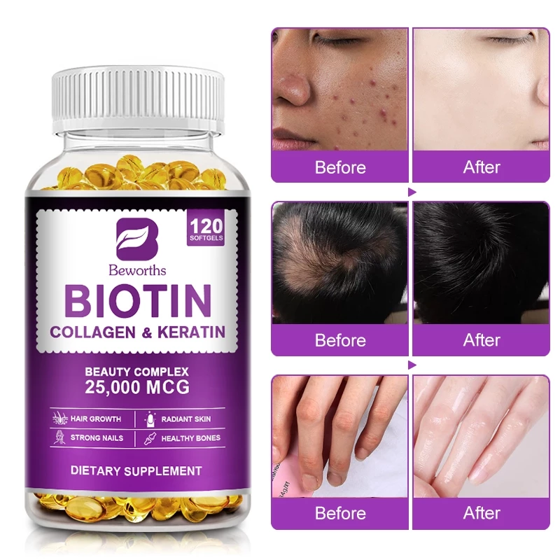 Biotin Collagen 25000mg เสริมผม เล็บ ผิวหนัง มัลติวิตามิน thumbnail 7
