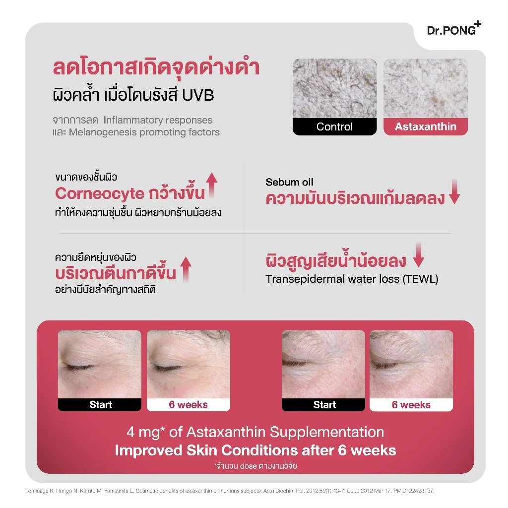 [ช้อปครบ รับฟรี] Dr.PONG Astaxanthin 6 mg AstaREAL ชะลอริ้วรอย ลดจุดด่างดำ ดอกเตอร์พงศ์ เนเชอรัล แอสตาแซนธิน 6 มก thumbnail 10