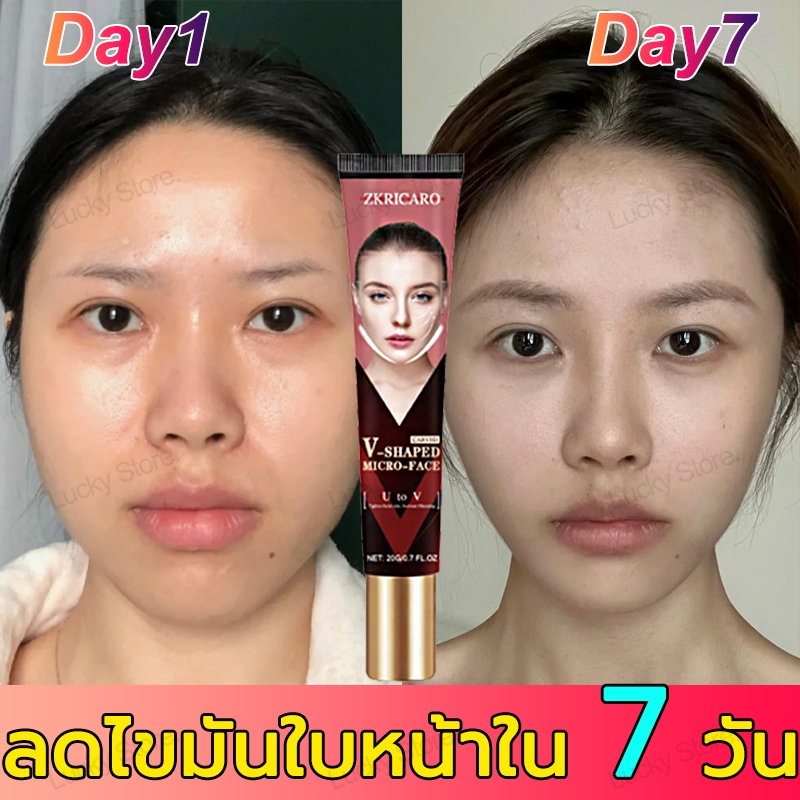 【ได้รับรอง FDA】 กำจัดเหนียง ที่ลดเหนียง ครีมกระชับสัดส่วนหน้าวีเชป ยกกระชับ และทำให้ผิวหน้ากระชับ ครีมหน้าตึง