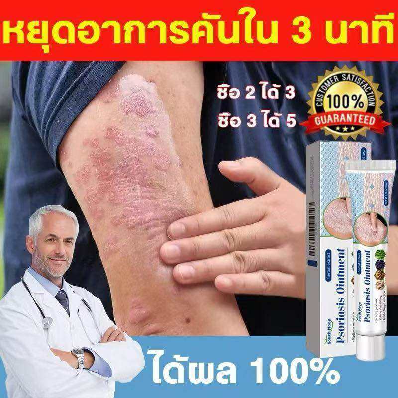 ครีมบำรุงผิวสำหรับความร้อนเต็มไปด้วยหนามเปียกและแห้งคันผิวหนัง1ชิ้นผลิตภัณฑ์ครีมแก้คันผิวสำหรับภายนอก