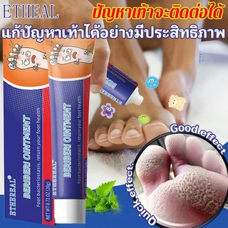 ครีมลดกลิ่นเท้า (ประสิทธิภาพดี เห็นผลเร็ว)แก้ไขปัญหาเท้า ระงับกลิ่นเท้า