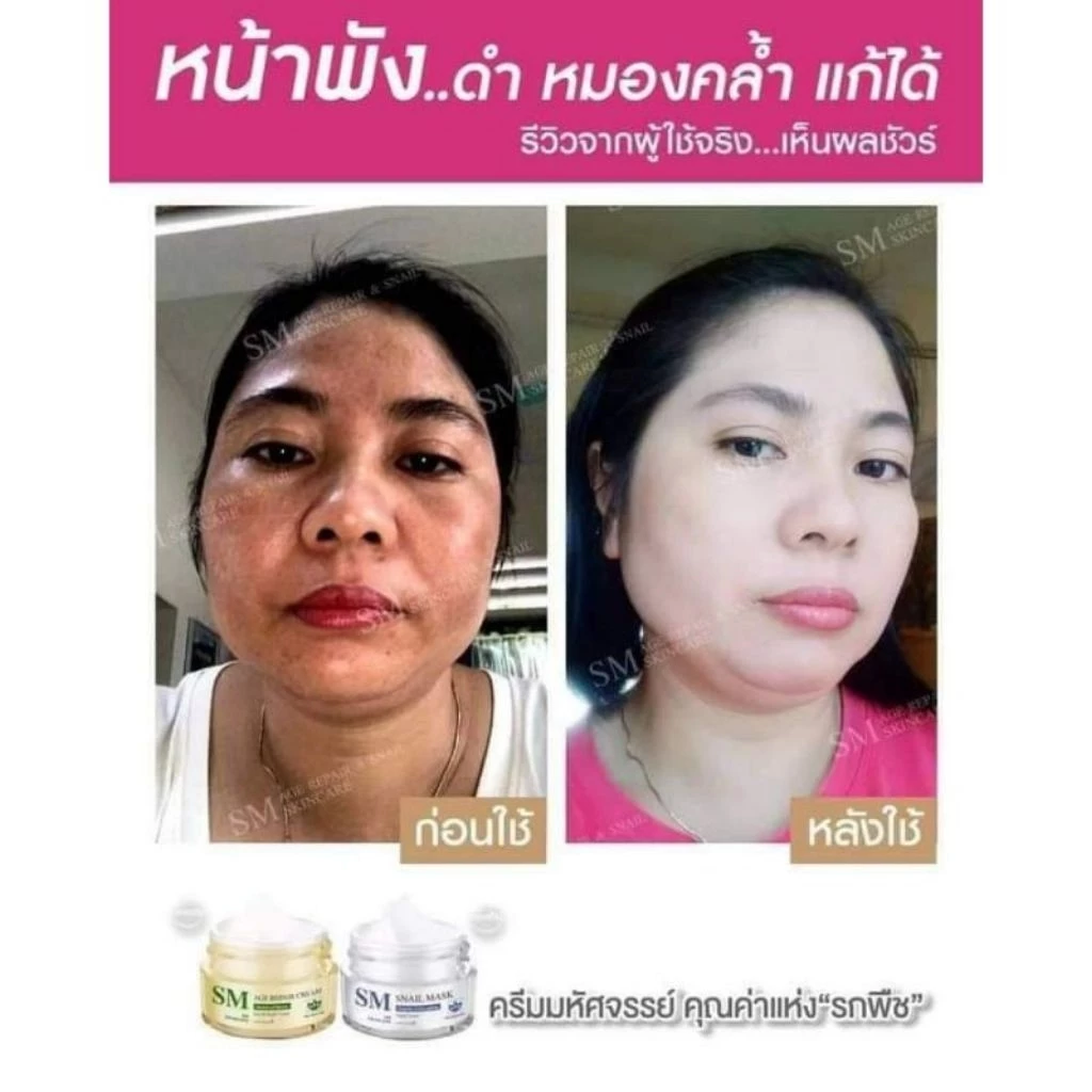 ✅ [ส่งฟรี+ส่วนลด] เซตครีมรกพืชเอสเอ็ม SM 15 g. #SM Skincare#เอสเอ็ม สกินแคร์ thumbnail 7