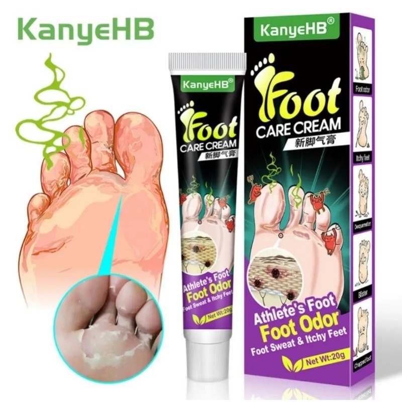 [พร้อมส่ง] ครีมทาน้ำกัดเท้า คันตามนิ้วเท้า เท้าอับชื้น เชื้อราที่เท้า ฮ่องกงฟุต