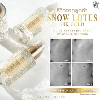 เซ็ทสุดคุ้ม 6 ขวด Madame Louise snow lotus 24K gold เซรั่มล้างหน้า