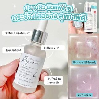 Dermadic เดิมมาดิก H 4 ซีรั่ม ลดเลือนหลุมสิวใหม่ ลดเลือนรอยแ…