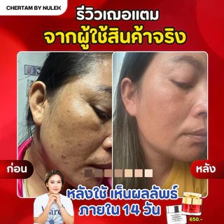 [ 1 แถม 1 ] ครีมโสมสลายฝ้า By หนูเล็กก่อนบ่าย