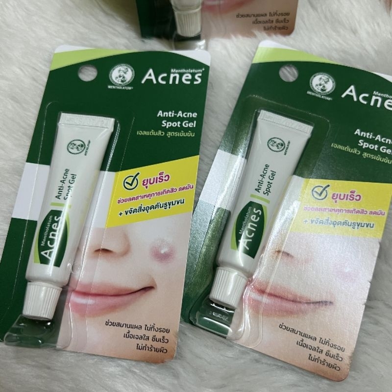 1 หลอด Mentholatum acnes prone skin oily เจลแต้มสิว เมนโทลาทัม ยุบ แห้ง ไว สิวอุดตัน สิวหนอง สิวผื่น