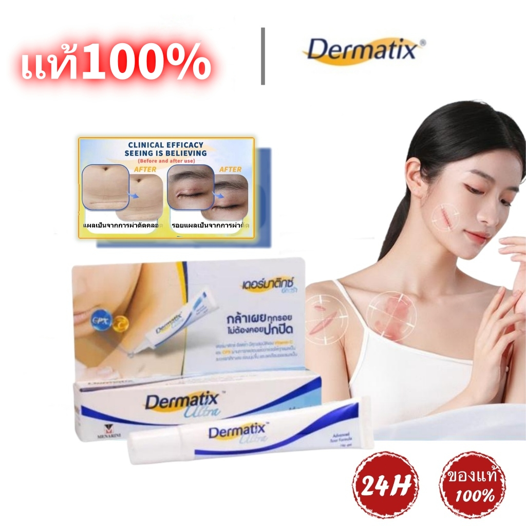 Dermatix ultra gel 15g Dermatix ultra gel 1 หลอด/15g. #Having ปีกสามารถรักษารอยแผลเป็นเช็ดรอยแผลเป็น