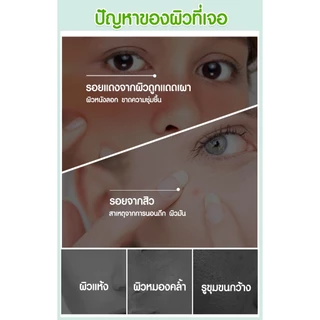 อโลเวร่าเจล เจลว่านหางจระเข้ เจลซ่อมผิว aloevera gel กระชับรูขุมขน บำรุงผิวพรรณ 300g.