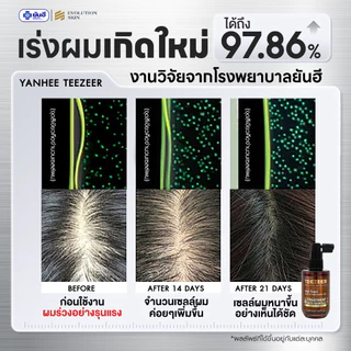 YANHEE TEEZEER ยันฮีทีเซอร์เซรั่ม เซรั่มปลูกผม 1 ขวด 60 ml ลดผมร่วง ปิดผมบาง ชะลอผมหงอก เร่งผมยาว ผมดกดำ