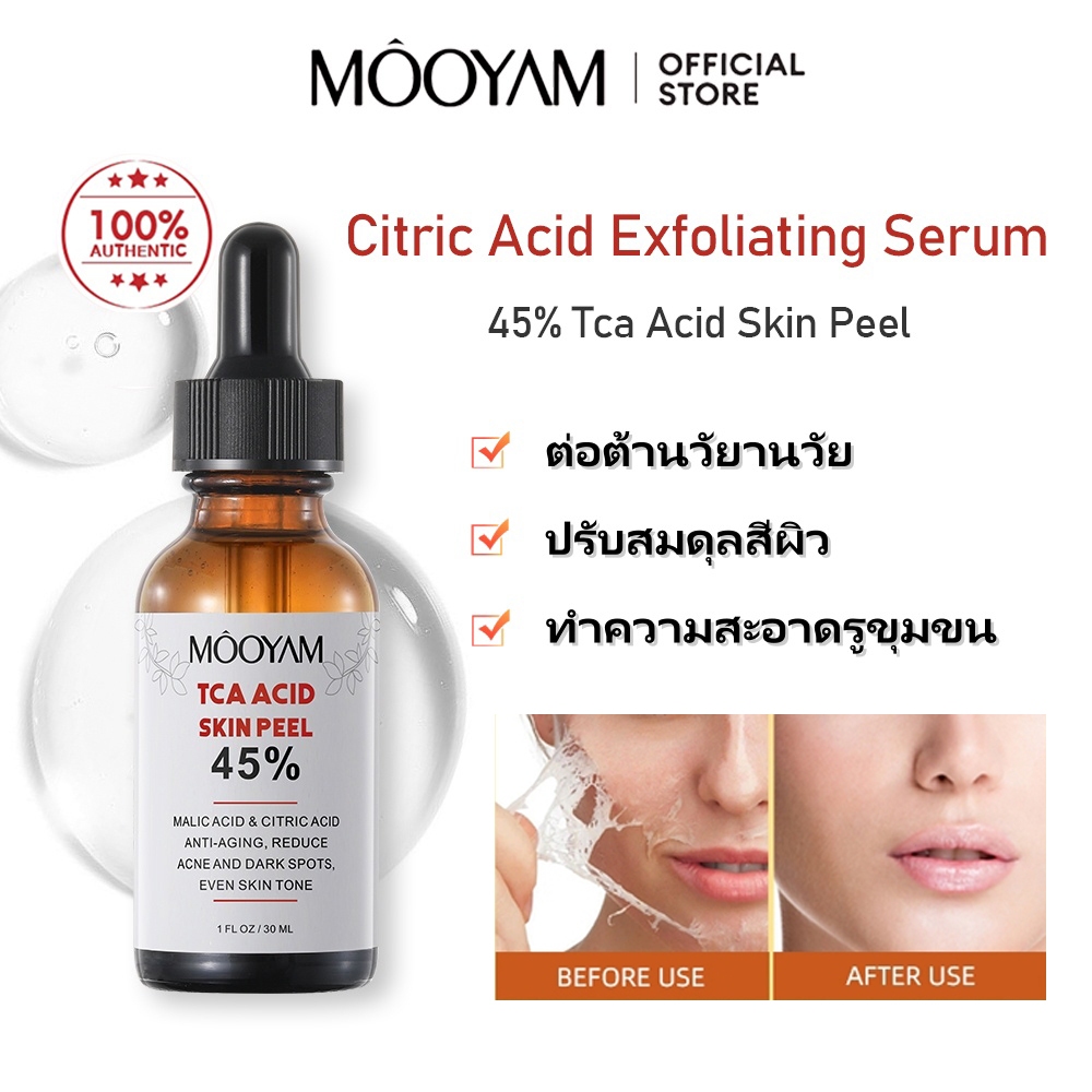 MOOYAM 45% TCA Acid Peeling Serum ลดรูขุมขน กรดซิตริก หน้าขัดผิว เอสเซนส์ เสริมเกราะป้องกันผิวให้แข็งแรง 30ml