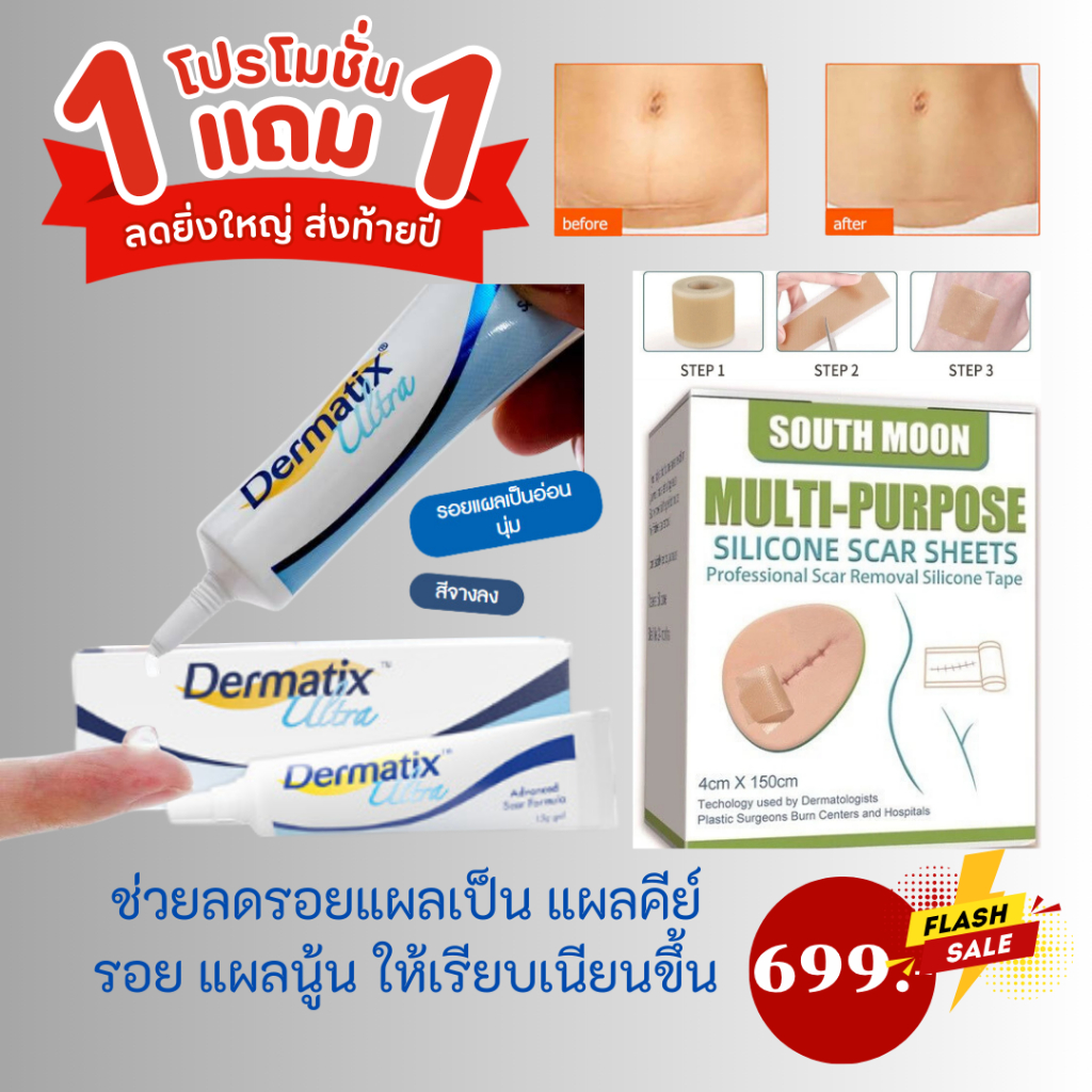 Dermatix ultra gel 15g Acne Scar เดอร์มาติกซ์ อัลตร้า+SOUTH MOON แผ่นซิลิโคนลดรอยแผลเป็น 4 cm* 150 cm.ลดรอยแผลเป็นรอยแตก