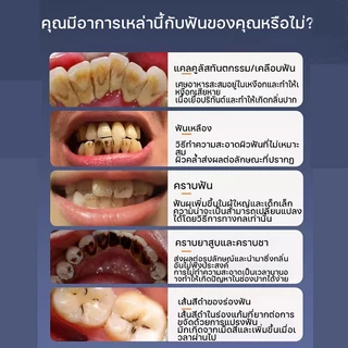 HYUNDAI เครื่องขูดหินปูน ที่ขูดหินปูน ขูดหินปูนเอง ไม่เจ็บเหงือก ขจัดหินปูนฟัน+แปรงฟัน tooth scaler