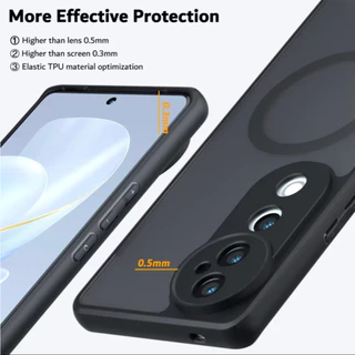 เคส Vivo V40 / V50 / V30 / V60 / V70 เคสแม่เหล็ก กันกระแทก ฝาหลังแข็ง ส่งจากไทย Frosted Case