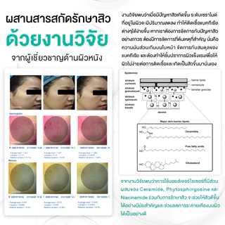 [ มอยส์ 1แถม1 ] D.Dee Moisturizer ลดรอยดำ ลดรอยแดง ลดรอยสิว ผิวชุ่มชื้น dr.dee