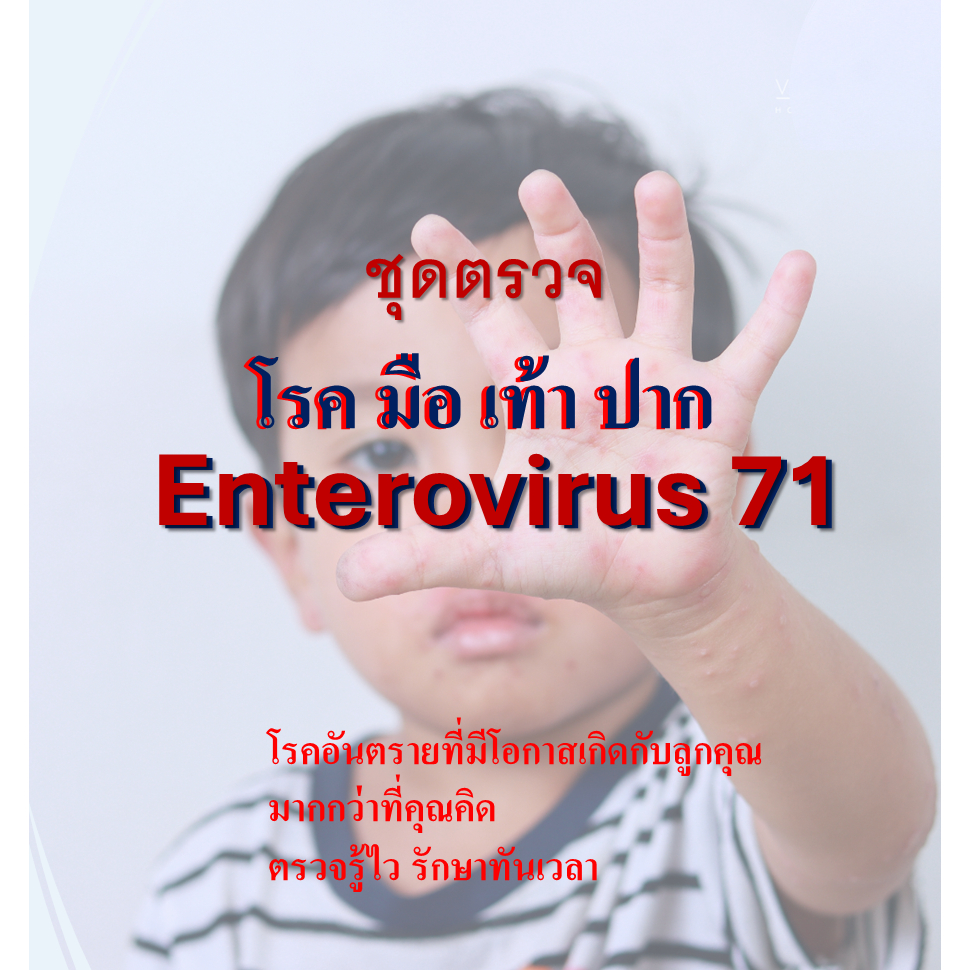ชุดตรวจคัดกรองการติดเชื้อ Enterovirus 71 เบื้องต้น สาเหตุโรคมือเท้าปาก จากเลือดและอุจจาระ