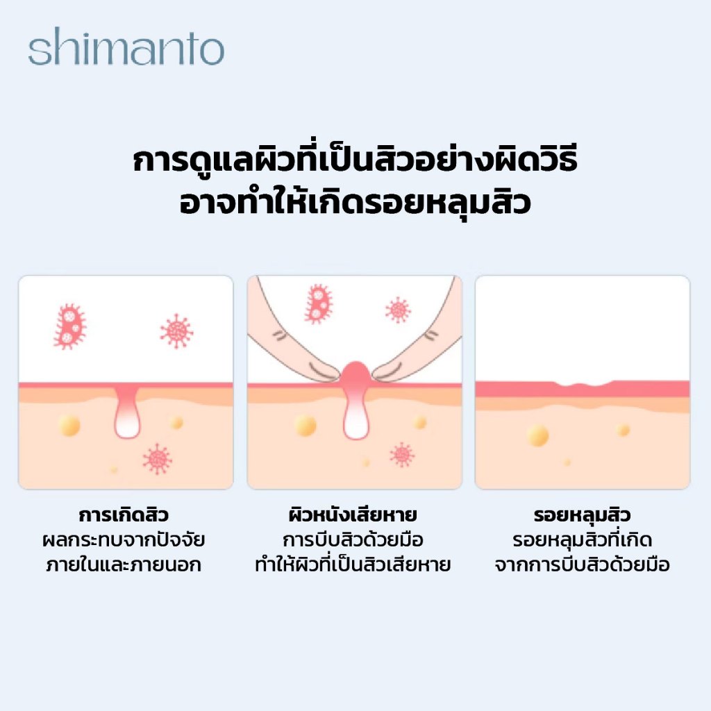 Shimanto แท้ แผ่นแปะสิว กันน้ำกันเหงื่อ ไม่มันเงา ผิวแพ้ง่ายใช้ได้ รักษาและปกปิดสิวอักเสบ - 4
