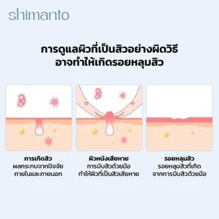 Shimanto แท้ แผ่นแปะสิว กันน้ำกันเหงื่อ ไม่มันเงา ผิวแพ้ง่ายใช้ได้ รักษาและปกปิดสิวอักเสบ