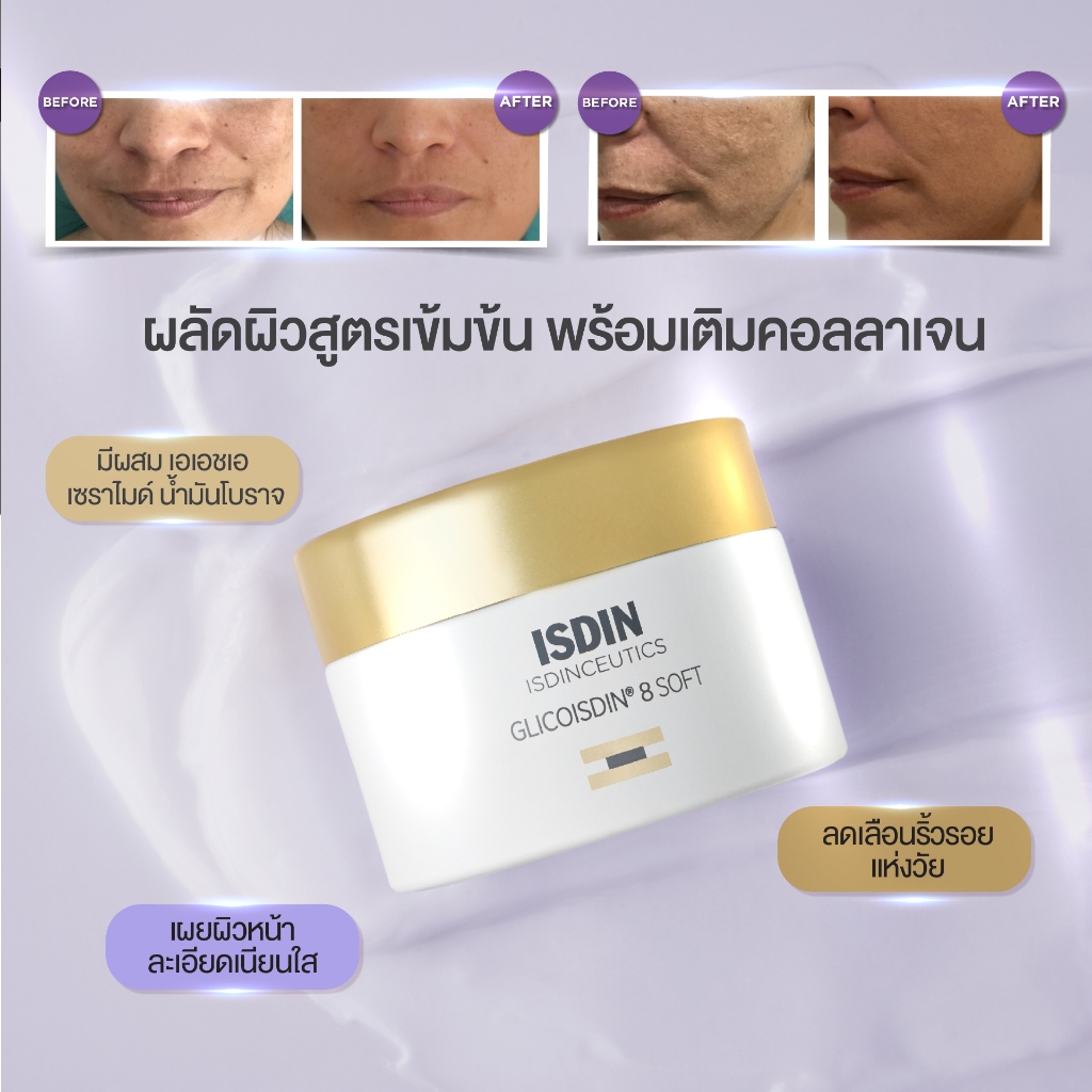 ISDIN ISDINCEUTICS GLICOISDIN 8 SOFT CREAM ครีมผลัดเซลผิวอย่างล้ำลึก เผยผิวหน้าละเอียดเนียนใส ลดเลือ