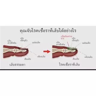 ของแท้ 100% LANBENA เซรั่มบำรุงเล็บ แก้เชื้อราที่เล็บ ไม่ทำร้ายเล็บดี ห่างกับปัญหาเล็บ ซ่อมแซมเล็บ ขนาด15ml
