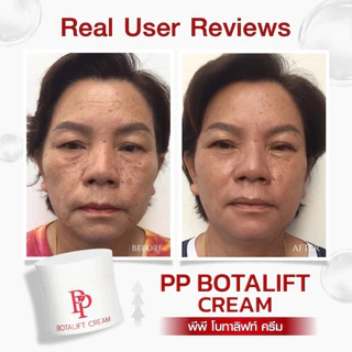 สวิสแล็บ เซรั่ม 2 ขวด + พีพี โบทาลิฟท์ ครีม 3 กระปุก SWISSLAB Serum + PP Botalift Cream