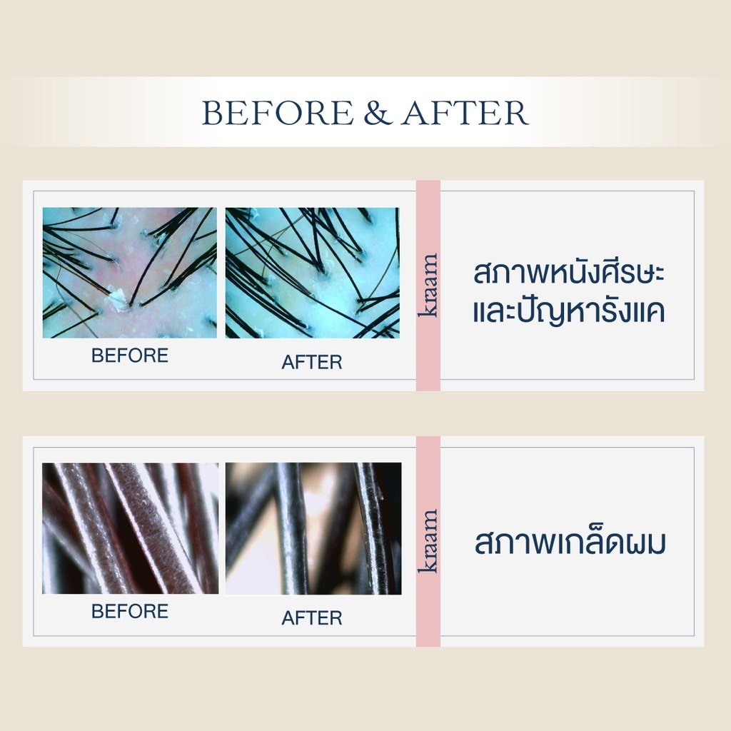 [ Set 2 ชิ้น ] Kraam  Hair&Scalp Detoxifying Shampoo + Detoxifying Conditioner - รูปที่ 6