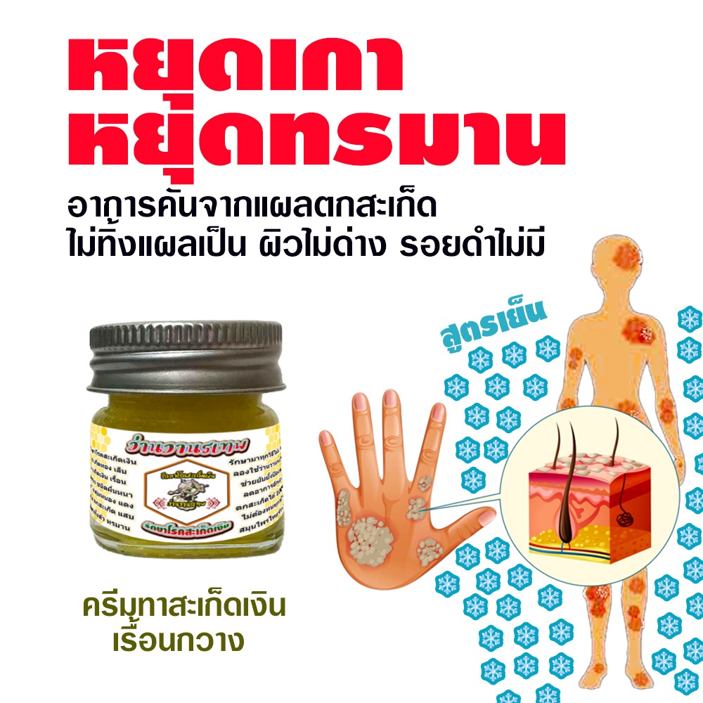 ครีมน้ำมันธรรมชาติสกัดช่วยกำจัดช่วยกำจัดแก้ สะเก็ดเงิน เรื้อนกวาง ให้คุณหมดกังวลปัญหาผิวร่างกาย หลังอาบน