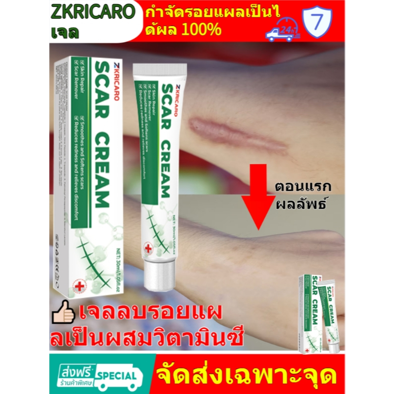 มีในสต๊อก🚀เจลรักษาแผลเป็น ครีมรักษาแผลเป็น เจลซ่อมแผล เจลรักษาแผลเป็น แผลผ่าตัด