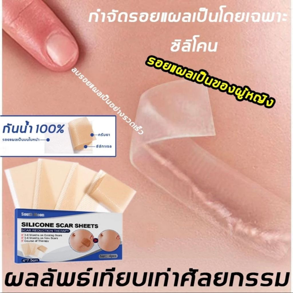 【🚚จัดส่งจากกรุงเทพฯ】south moon แผ่นแปะแผล silicone scar sheet แผ่นแปะแผลเป็น 4cm*150cmํ ปิดแผลเป็น