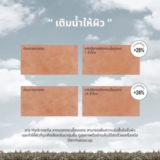 LANOS น้ำตบลานอส น้ำตบมอยซ์ ผิวอิ่มน้ำนาน 72ชม. (ของแท้บริษัท) 120 ml.