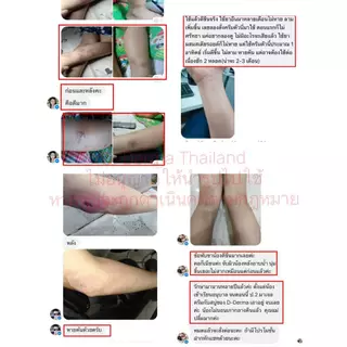 (เจ้าของ) D-Derma สบู่ว่านและครีม การคัน ผดผื่น สะเก็ดเงิน ผิวหนังอักเสบ กลากเกลื้อน เชื้อรา