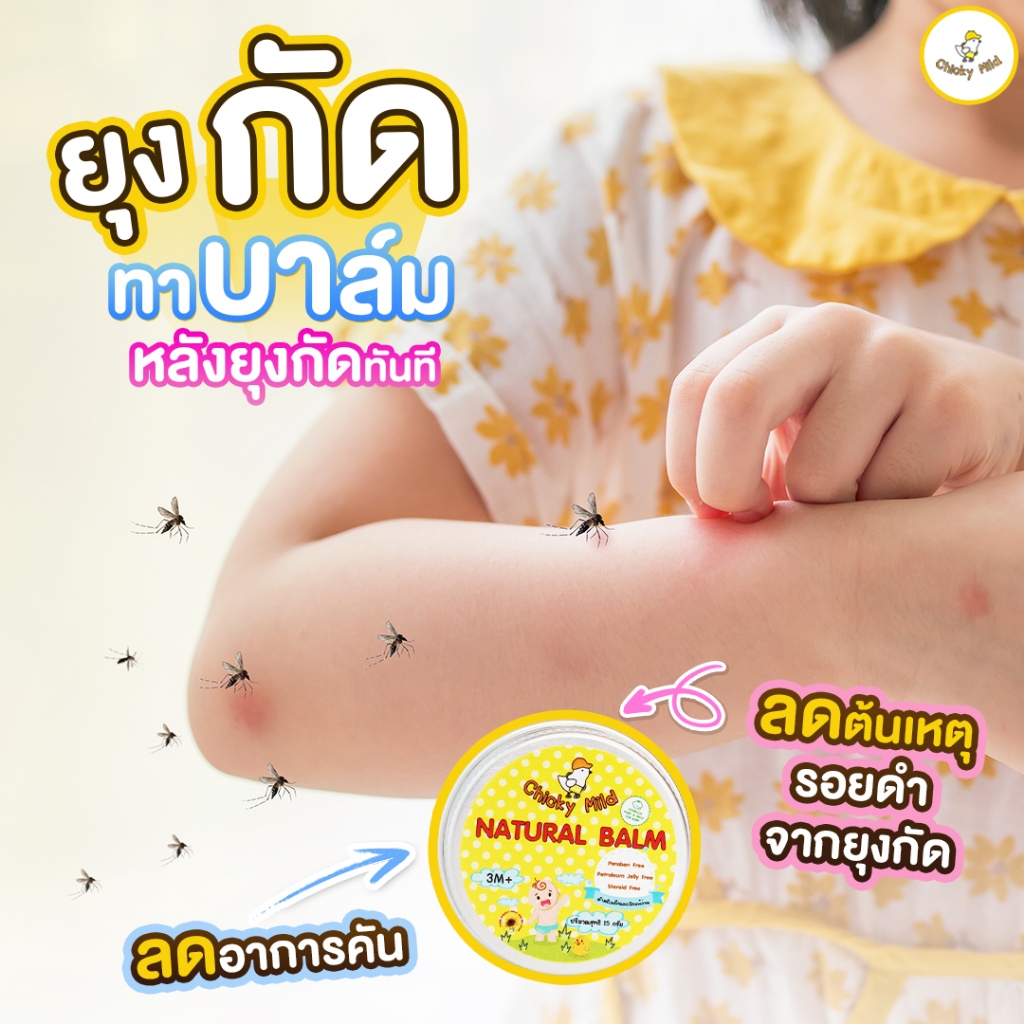 Chicky Mild บาล์มทายุงกัด บาล์มลดคัน ลดบวมแดง แพ้ยุง ไม่ทิ้งรอยดำ ป้องกันขาลาย สูตรสารสกัดธรรมชาติ
