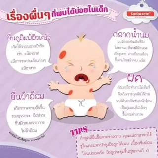 【ส่งจากไทย】ครีมทาก้นเด็ก ของแท้ 100% 60g ซูโดครีม แก้ผื่นผ้าอ้อม ผิวแห้ง Sudo Cream