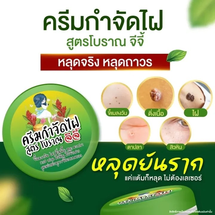 ครีมไฝจีจี้ ขี้แมลงวัน ติ่งเนื้อ หูด ตาปลา แก้ปัญหา กระ สิวหิน ครีมแต้มไฝจีจี้ไฝ หูด จี้ไฝ แต้มไฝ