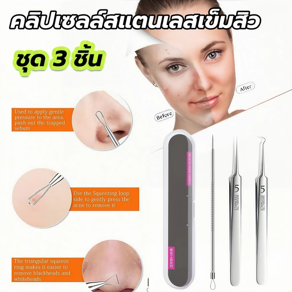 (ชุด3 ชิ้น)แหนบหนีบสิวเสี้ยน สิวเสี้ยน เบอร์ 5 คลิปเซลล์สแตนเลสเข็มสิว แบบบางพิเศษ เครื่องมือความงาม