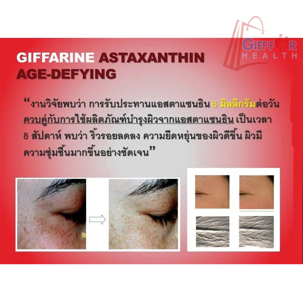 อาหารเสริม Giffarine Astaxanthin 30 แคปซูล thumbnail 8